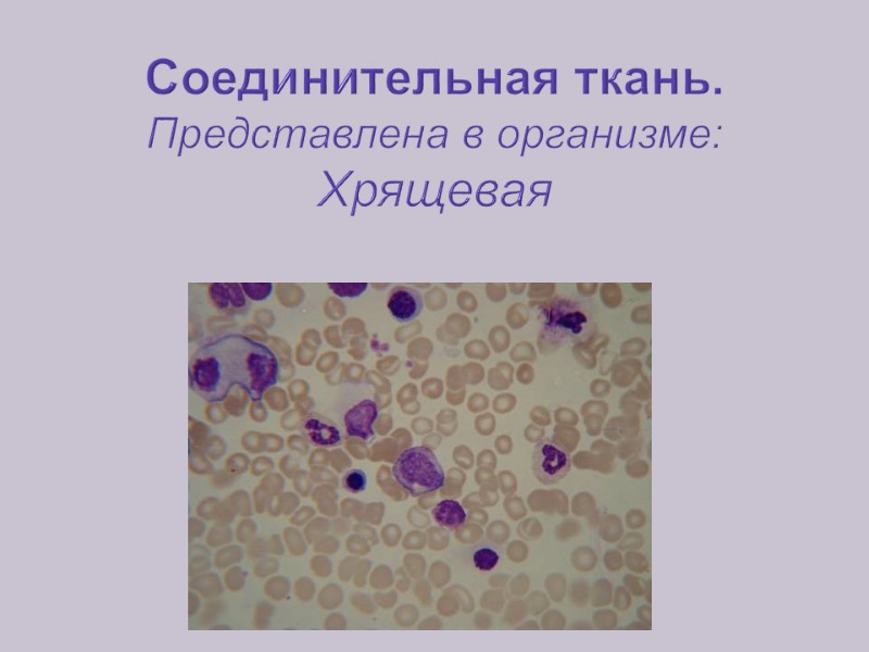 Соединительная ткань. Представлена в организме: Хрящевая